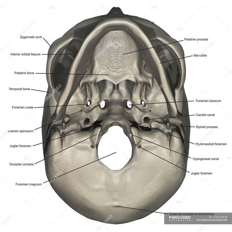 Inferior view of human skull anatomy with annotations — styloid process ...