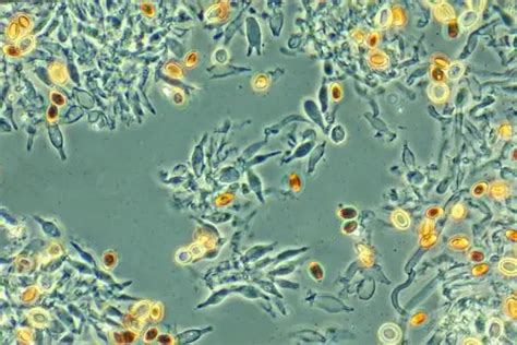 Phase Contrast Microscopy: A Simple Explanation – Microscope Clarity