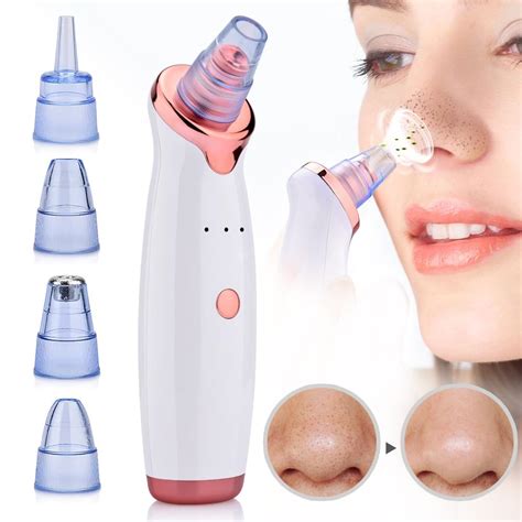 Blackhead Remover Pore Cleaner Vacuum Suction Tool – Rabbit Quick