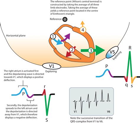 The ________________ represents ventricular depolarization in the ...