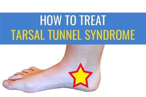 Medial Ankle Pain: Tarsal Tunnel Syndrome | Sports Injury Physio