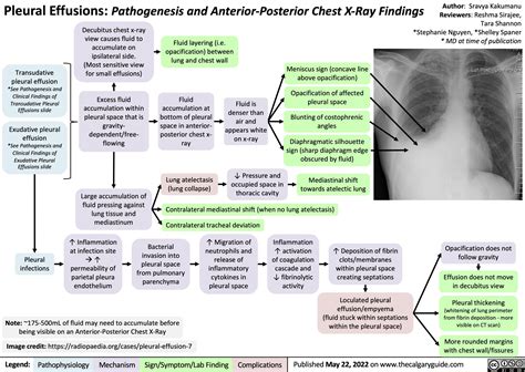 Pathophysiology Of Pleural Effusion | The Best Porn Website