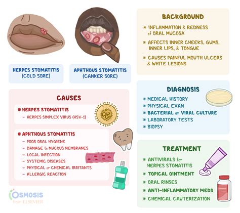 Stomatitis: What Is It, Causes, Signs, and More | Osmosis