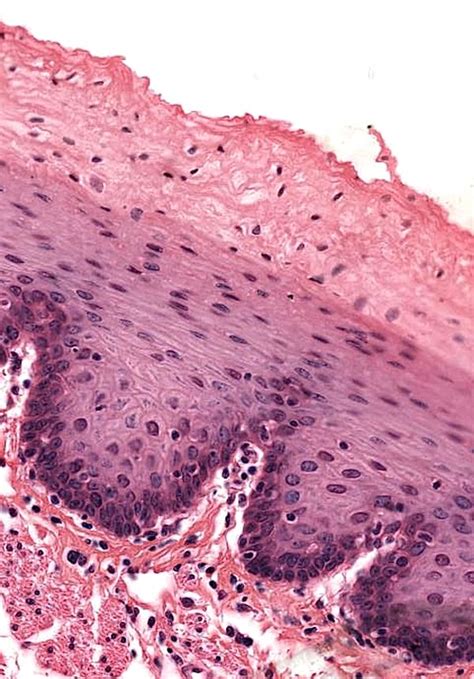 Non-Keratinized Stratified Squamous | AnatomyBox | Stratified squamous ...