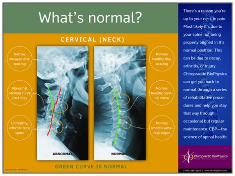 Abnormal Cervical Spine Mri