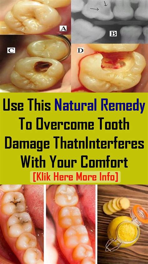 Pin by Dieshia Broner on home remedies in 2020 (With images) | Natural ...