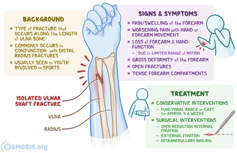 Distal Ulna Fracture: What Is It, Management, and More | Osmosis