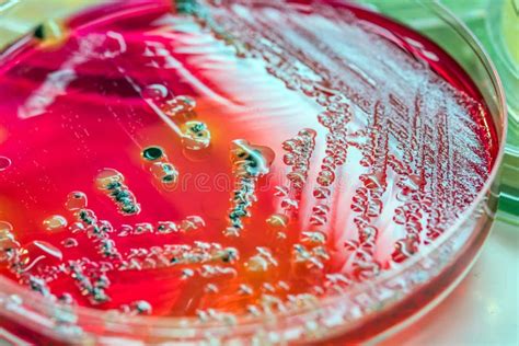 Bacterial Colonies Culture on Selective Agar Media(SS Agar). Stock ...