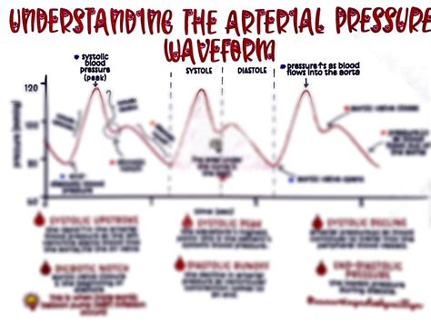 The Arterial Line ABP Waveform - Etsy Canada