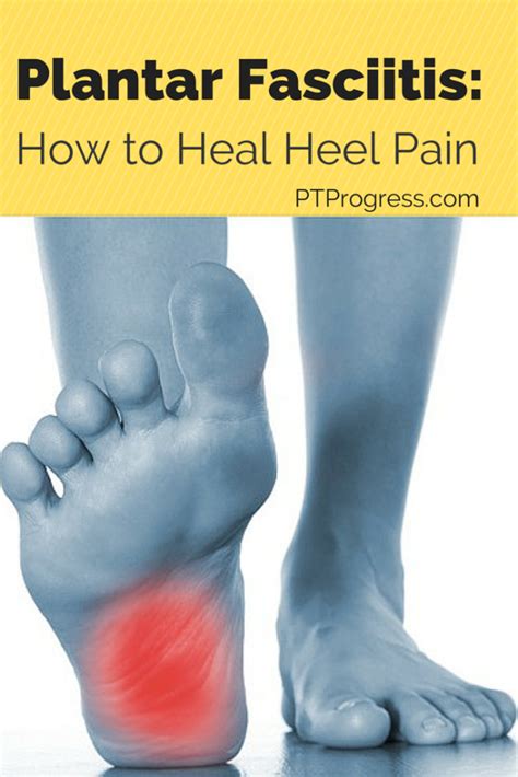 Plantar Fasciitis Treatment: How to Heal Heel Pain