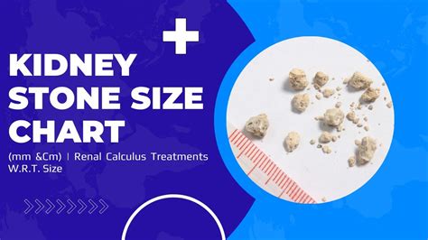 Normal Size Of Kidney Stone In Mm