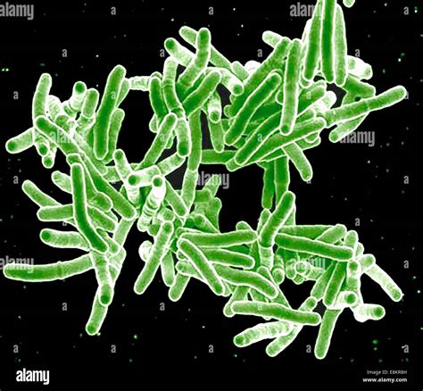 Scanning electron micrograph of Mycobacterium tuberculosis bacteria ...