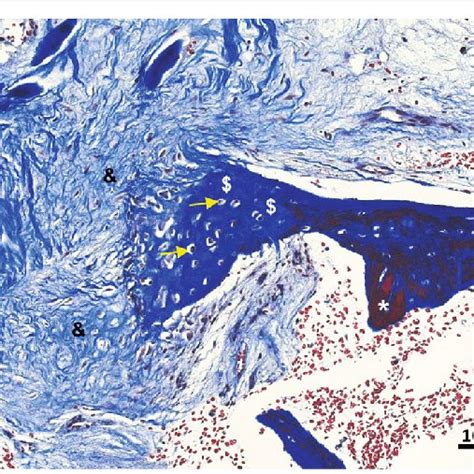 New bone formation 3 months after V-CBA implantation. Masson's ...