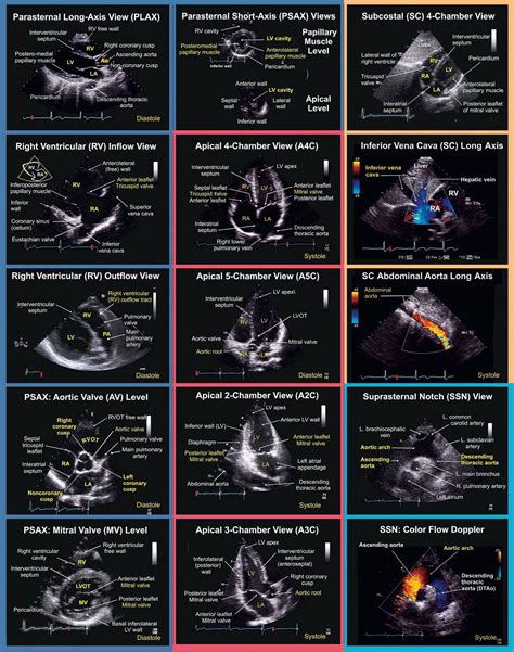 Pin on Ultrasound