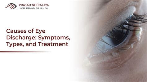 Causes of Eye Discharge: Symptoms, Types, and Treatment - Prasad Netralaya