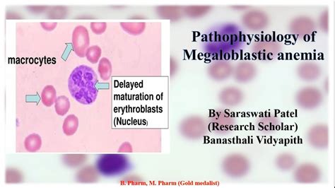 pathophysiology of Megaloblastic anemia - YouTube