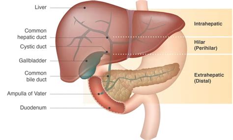 About Cholangiocarcinoma | What is Cholangiocarcinoma?