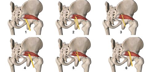 Piriformis