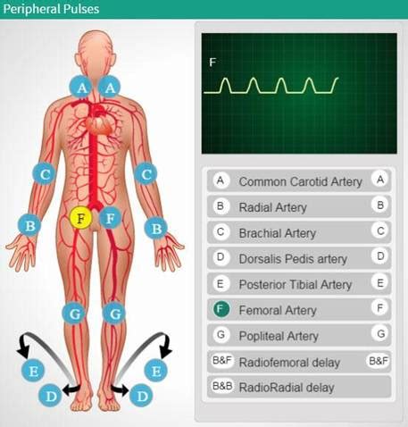 Peripheral pulses