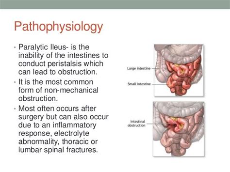 Pin by Tina Young on Nursing | Nursing notes, Med surg nursing, Nursing ...