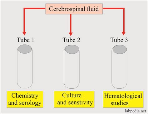 Csf chloride. Significance of chloride contents in cerebrospinal fluid ...