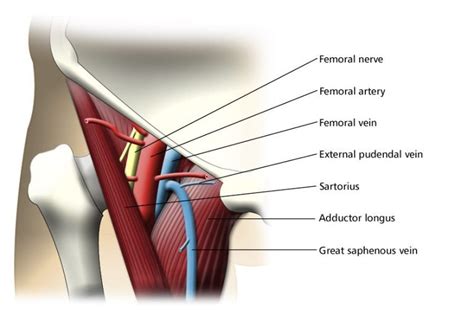 Central line (femoral) - Alberta Sono