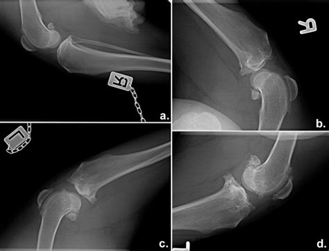 Representative X-ray photographs of both knees from same dog before ...