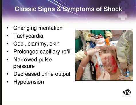 PPT - Hemorrhagic Shock PowerPoint Presentation, free download - ID:2067245