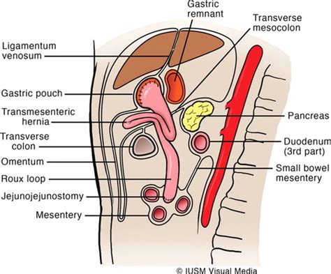 Retroperitoneal Diagram