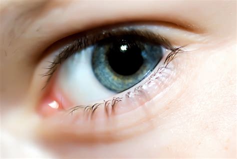 Eyelid Twitching: Causes, Treatment, and Prevention