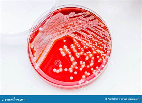 Staphylococcus Aureus Royalty-Free Stock Photo | CartoonDealer.com ...