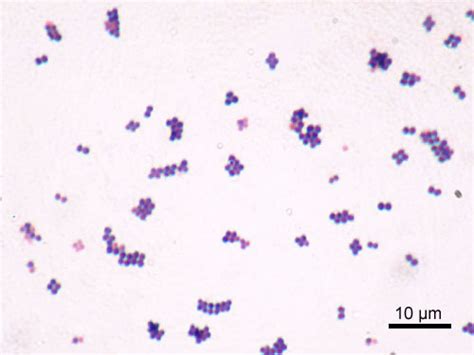 Difference Between Cocci and Bacilli | Characteristics, Structure, Examples