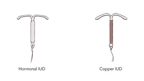 IUD Birth Control | Info About Mirena & Paragard IUDs