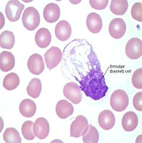 Pin by Emel Ahmedova on Hematology Laboratory | Hematology, Smudging ...