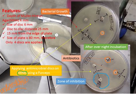 Mueller Hinton Agar (MHA): Introduction, Composition, preparation and its