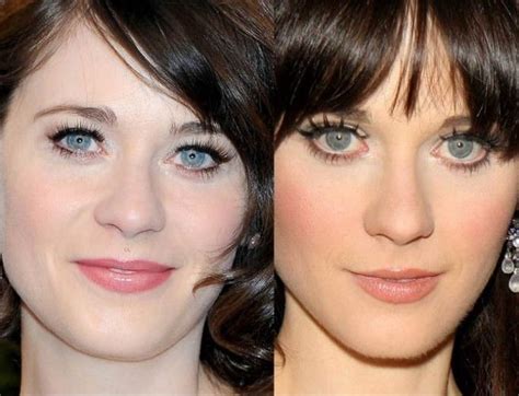 Zooey Deschanel before and after eyelid surgery – Celebrity plastic ...