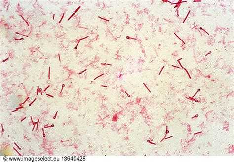 Light micrograph (LM) showing the bacteria species Clostridium tetani ...