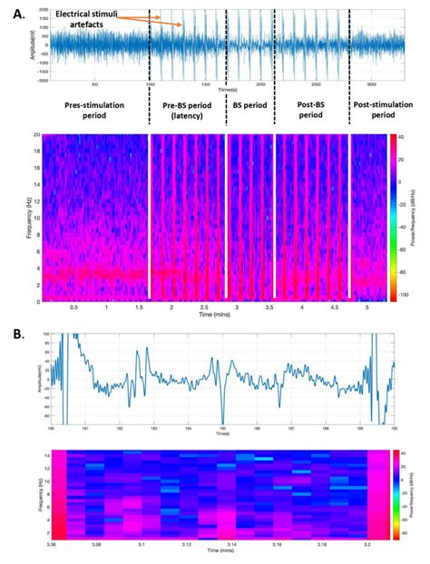 Electrocorticogram changes during claustrum stimulation. (A) Frontal ...