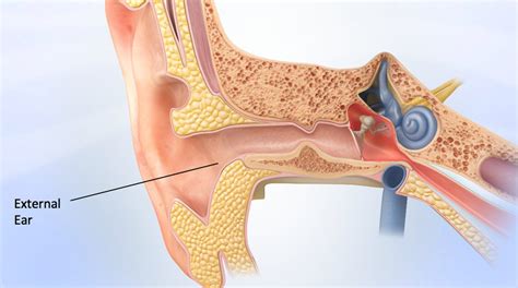 Surfer's Ear Treatment Los Angeles, CA