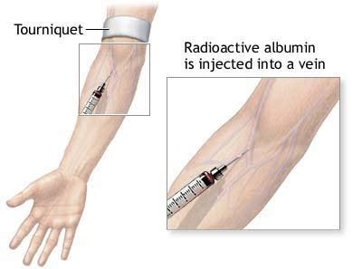 mynsgnotes.blogspot.com: Intravenous Injection (IV INJECTION)