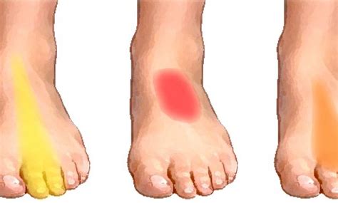 What Causes of Foot Pain Symptoms