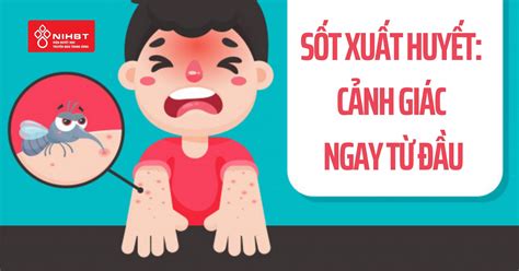 Sốt xuất huyết và những điều cần biết - Viện Huyết học - Truyền máu ...