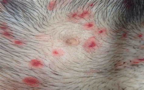 Ringworm in Dogs is Actually Fungus. It Lasts about 3 Weeks to Get Rid ...