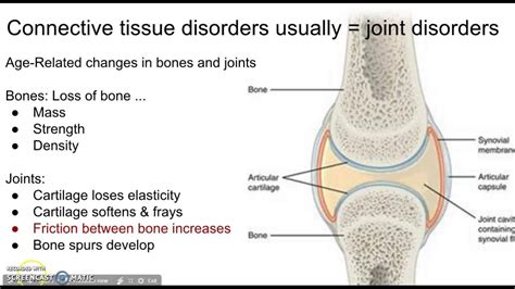 ASK About Vitamins: Connective Tissue Disorders Try #Serracor #Healthy ...