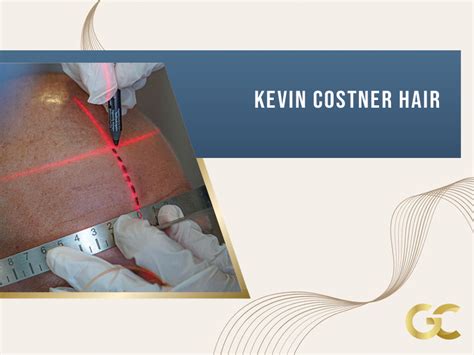 Who Is Kevin Costner? - Gold City Best Hair Transplant Turkey