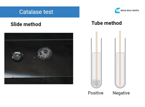 Understanding the Catalase Test: Principle, Procedure, and Methods