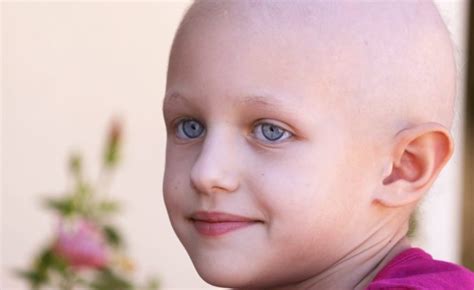 Leukemia in children: Most common cancer in children – Vitamin Resource