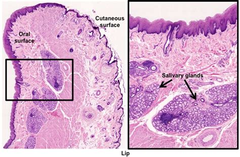 Lip Histology Labeled - Infoupdate.org