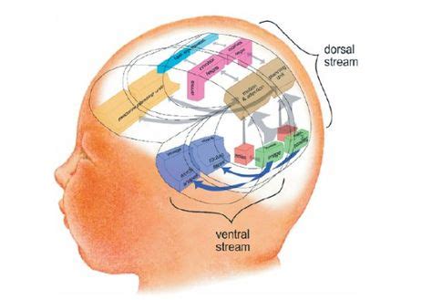 9 Best Cortical Vision Impairment (CVI) ideas | cortical vision ...