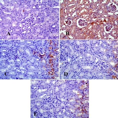 A. Caspase-3 immunohistochemistry of a liver from a control rat ...